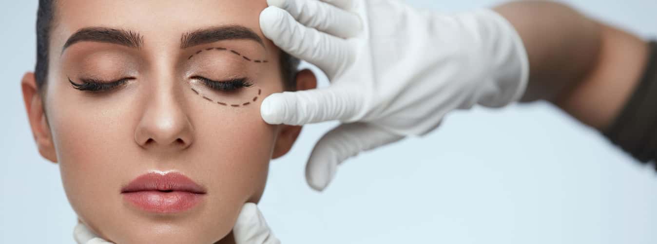 Blepharoplasty before and after