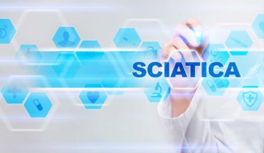 How to relieve sciatic pain