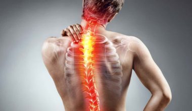 Scoliosis in adults