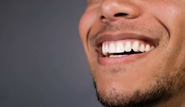 Healthy teeth