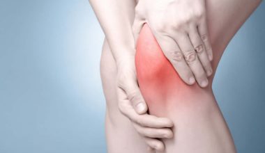 Should you put ice on a burn
