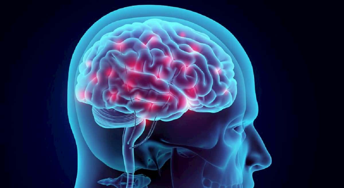 Post-Concussion Syndrome