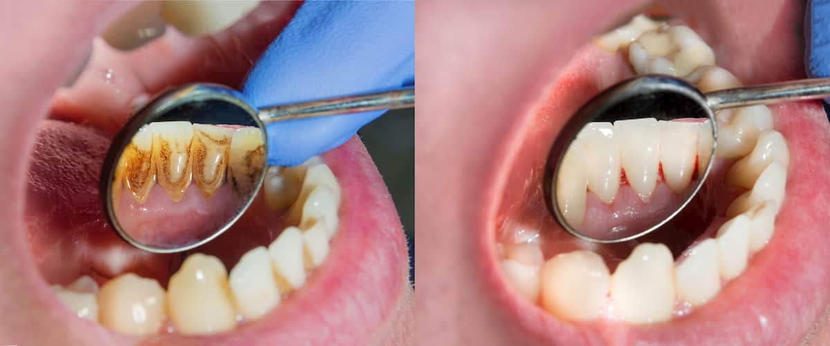 Common dental problems