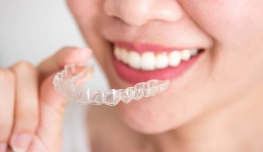 Invisalign process