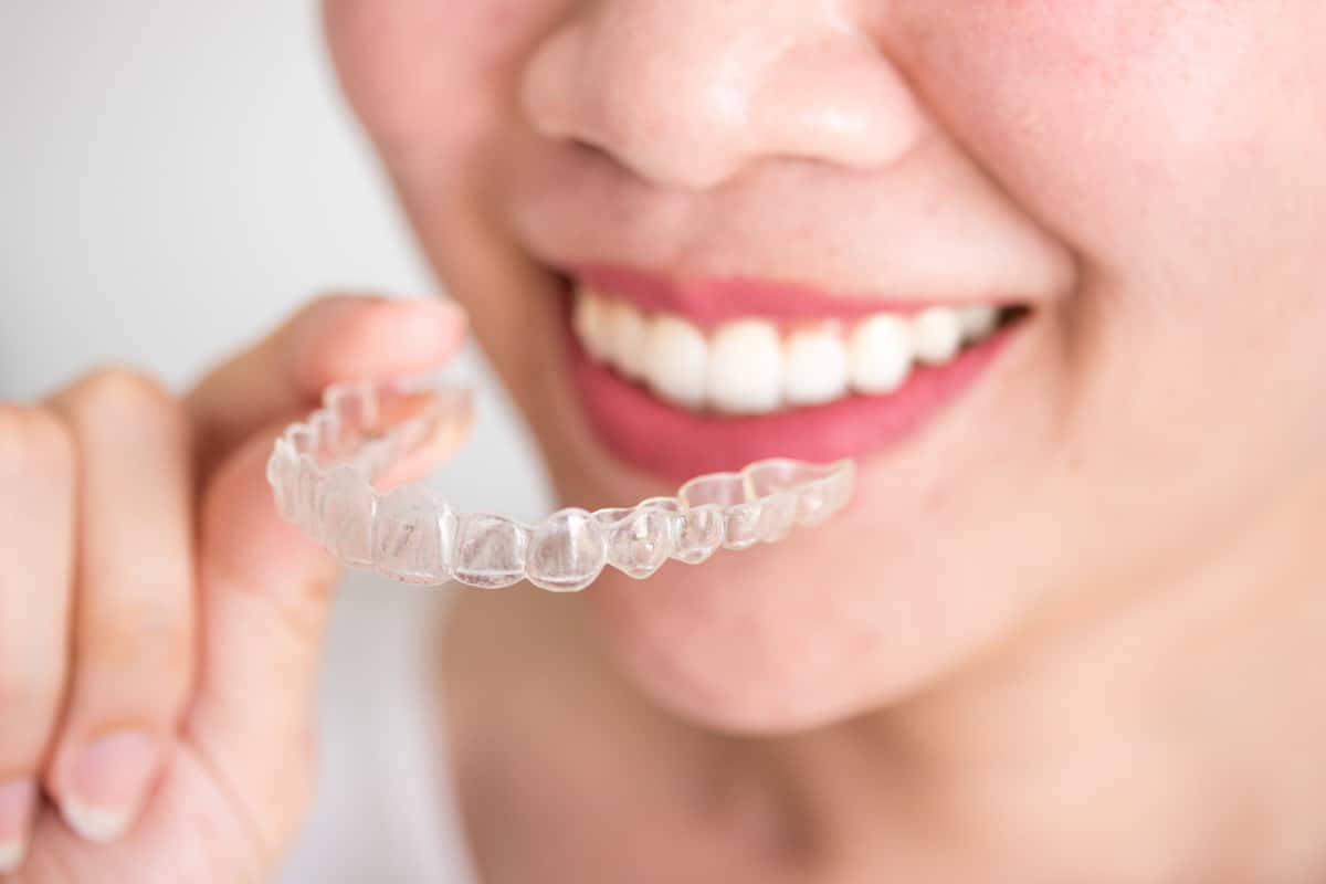 Invisalign process