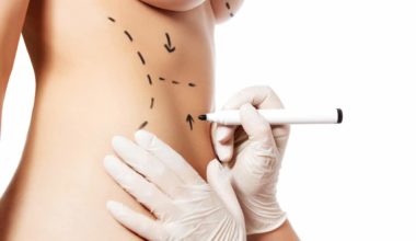 Non-surgical cosmetic procedures