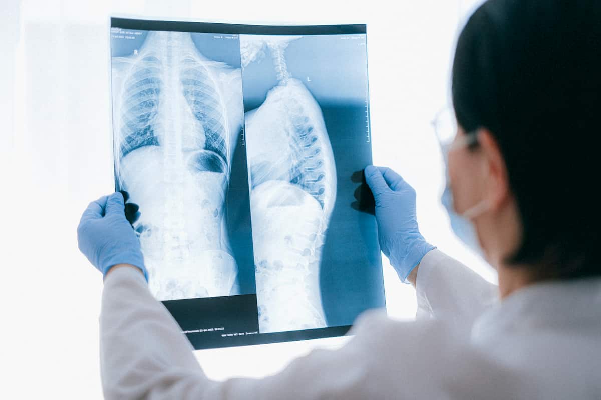 lung-cancer