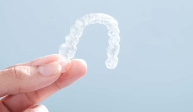 Removable braces