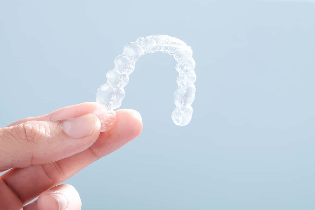 Removable braces