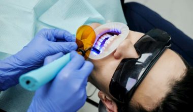 Dental scanners