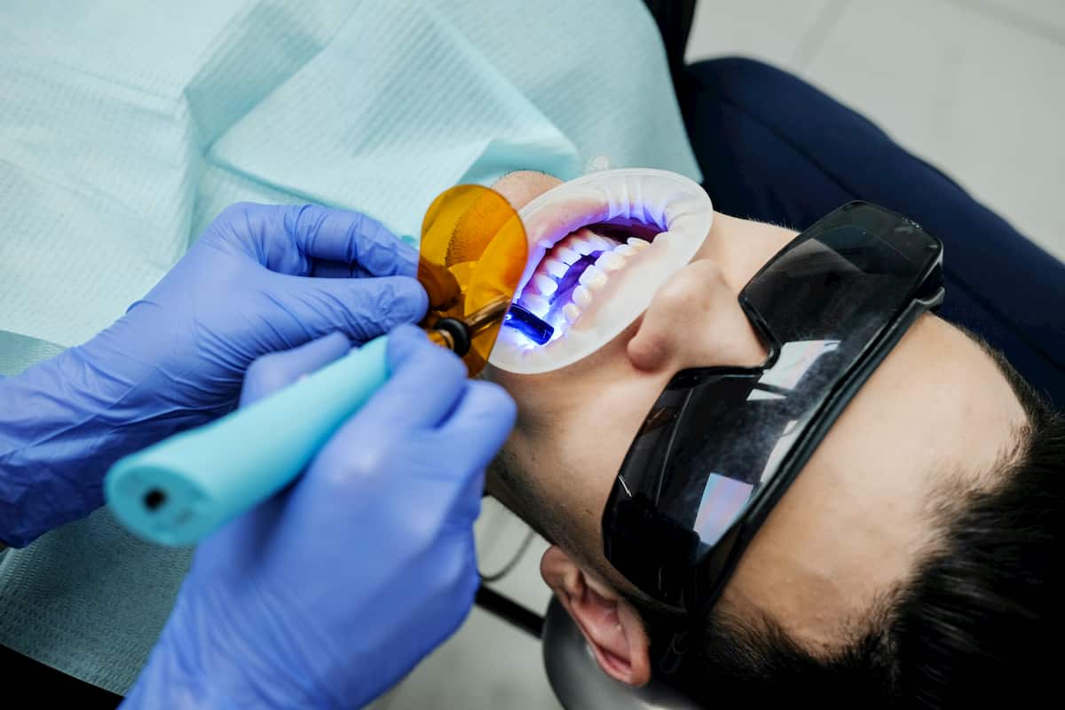 Dental scanners
