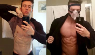 Need To Know About Melanotan