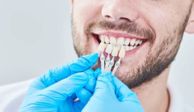 Dental crown replacement