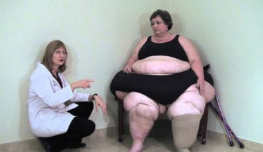 Lipedema fat vs regular fat