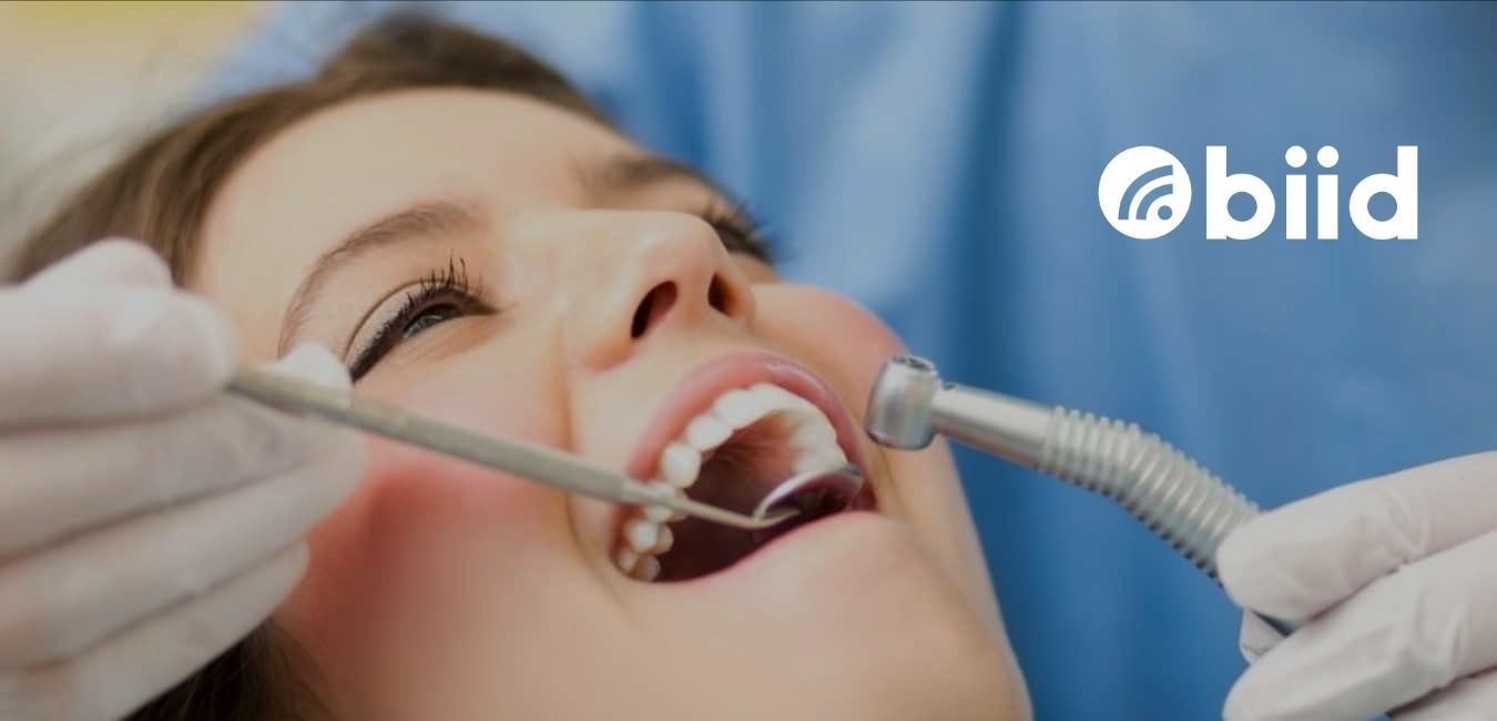 Veneers