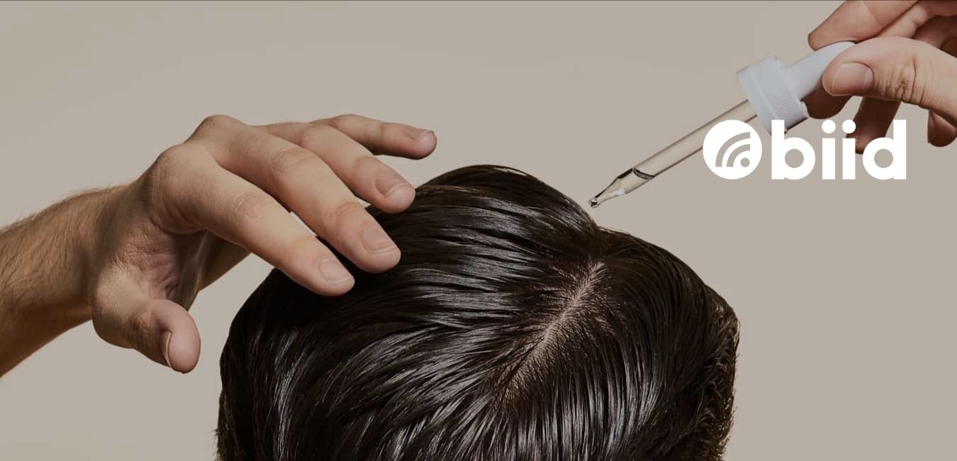 Minoxidil and Finasteride