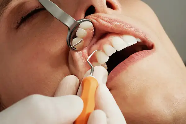 Dental implants
