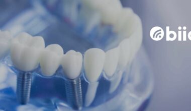 Cost of full mouth dental implants