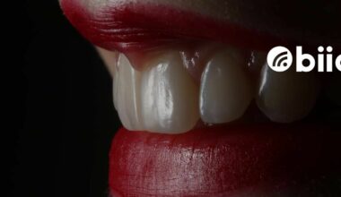 Tooth Discoloration