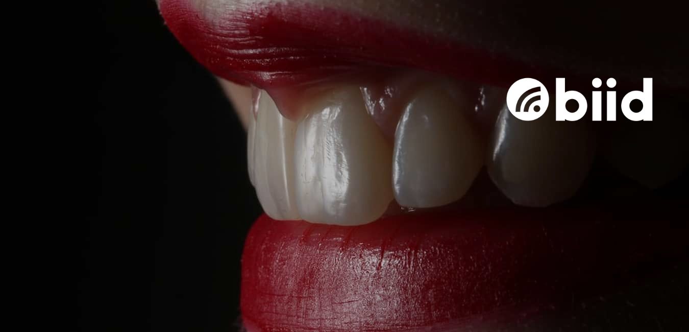 Tooth Discoloration